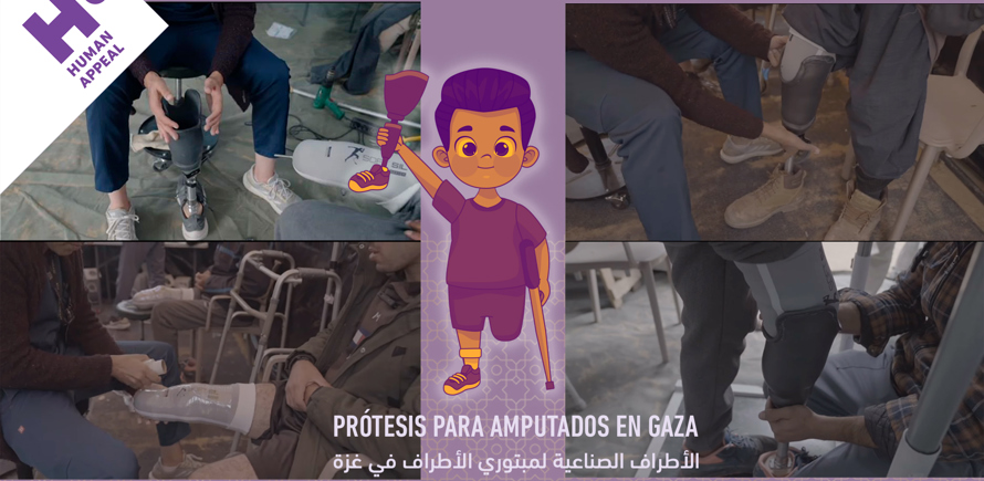 Prótesis para personas amputadas en Gaza