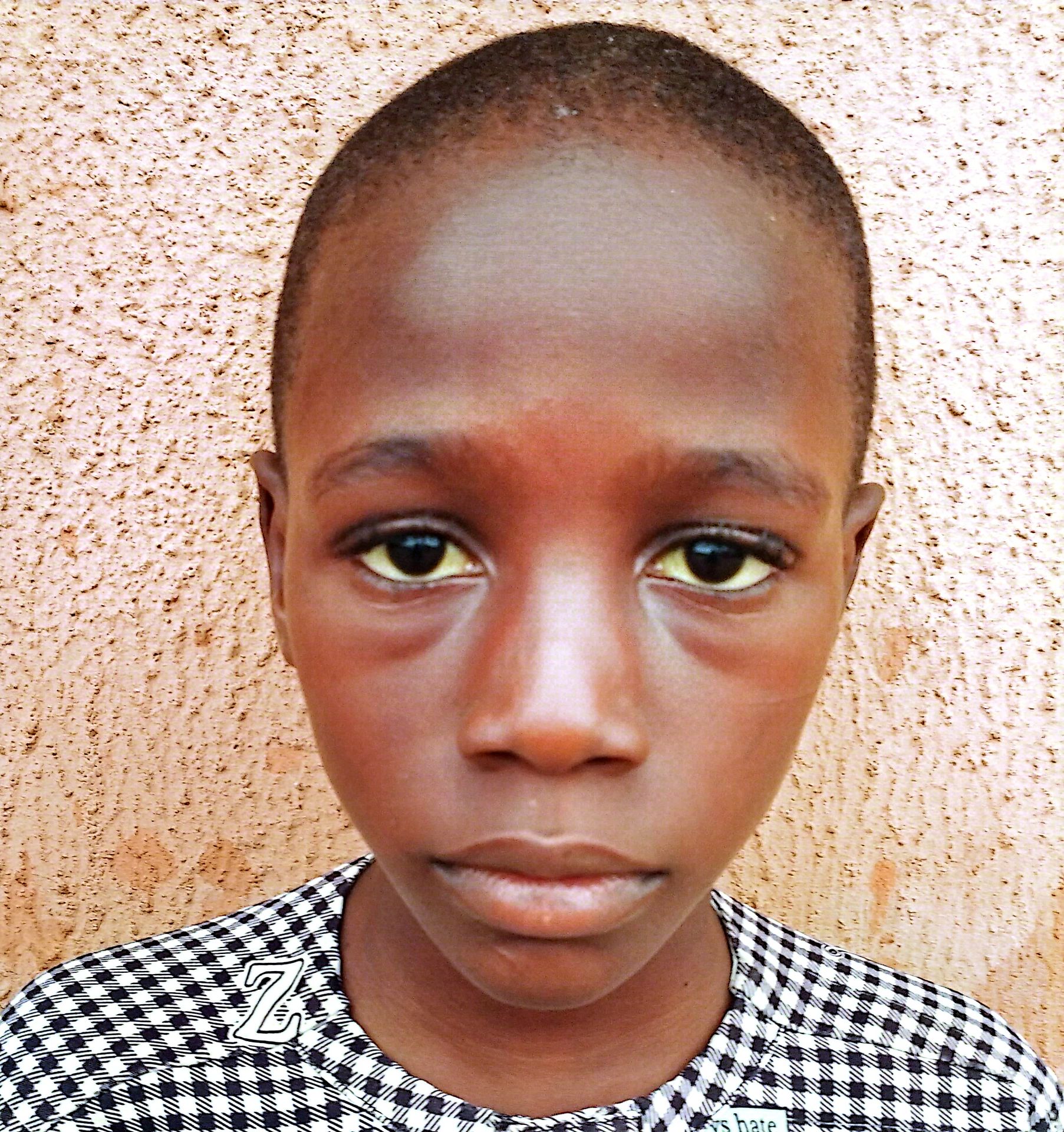 Yatimi - Human Appeal - Awwal