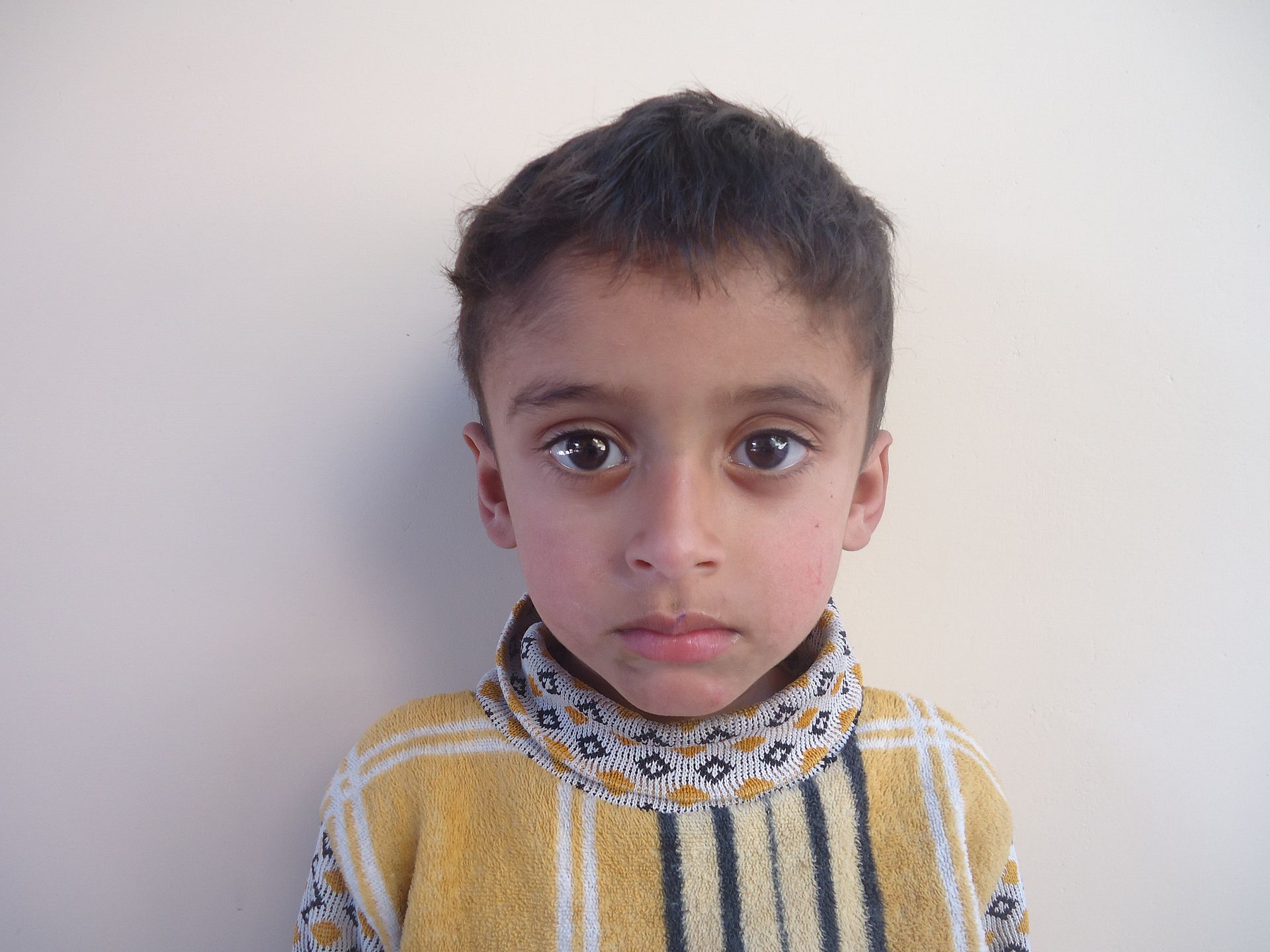 Yatimi - Human Appeal - Abrak Ali